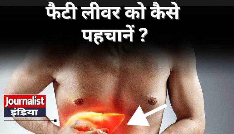 fatty liver symptoms in hindi