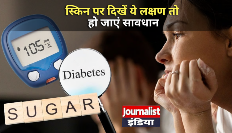 Diabetes in India